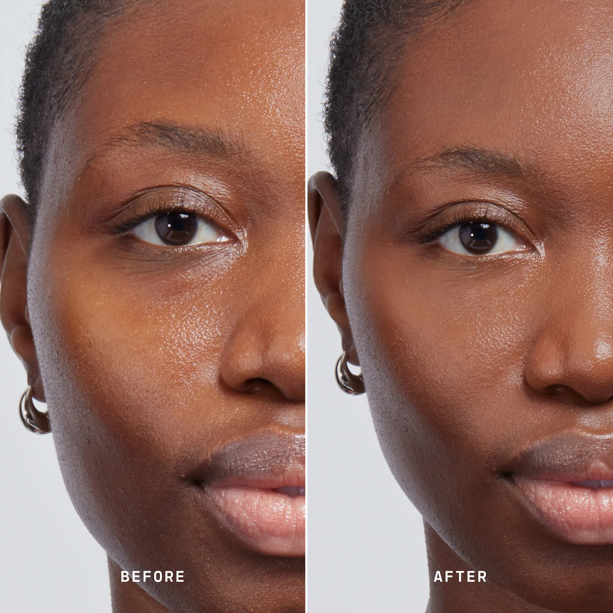 Skin Solution - Image 171